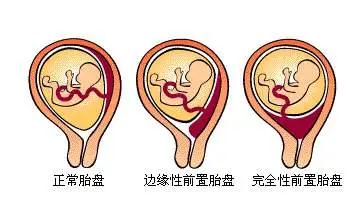 比賽展風(fēng)采，實(shí)戰(zhàn)驗(yàn)真金